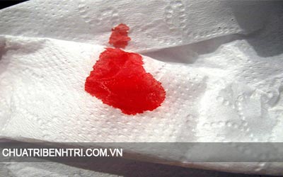 Hiện tượng đi đại tiện ra máu tươi